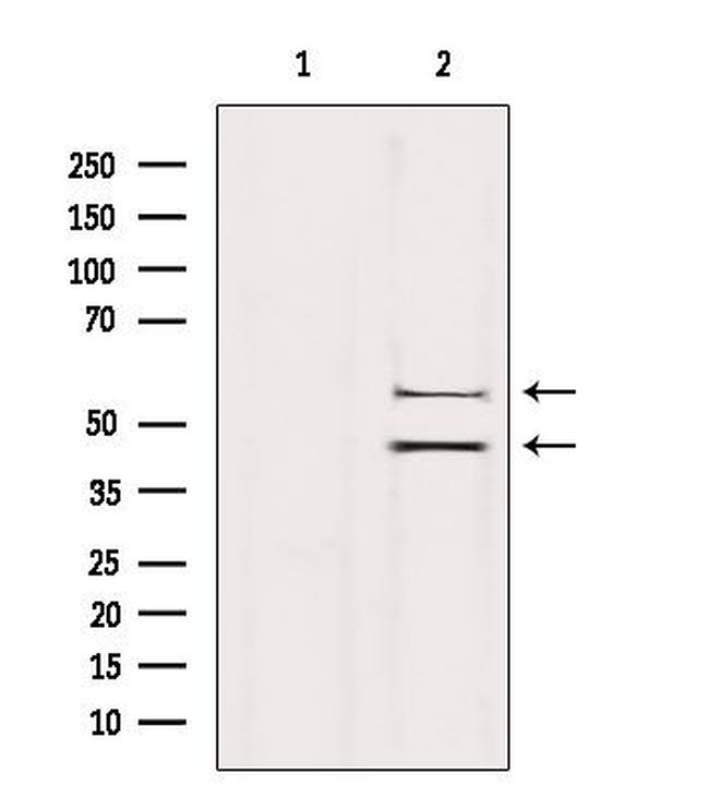 JNK1/JNK2/JNK3 Antibody in Western Blot (WB)