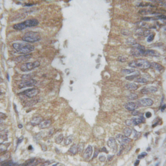 PLA2G4A Antibody in Immunohistochemistry (Paraffin) (IHC (P))