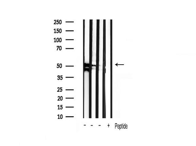 GSK3 alpha/beta Antibody in Western Blot (WB)