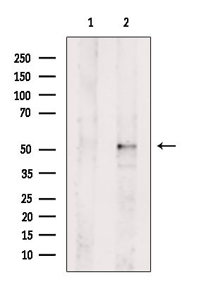 GSK3 alpha/beta Antibody in Western Blot (WB)