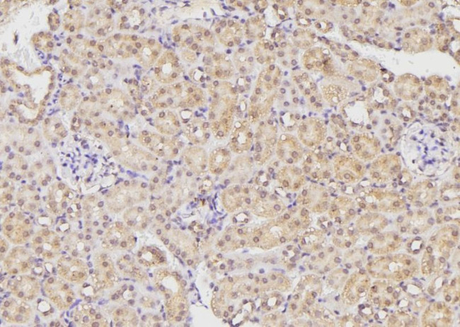 ETK Antibody in Immunohistochemistry (Paraffin) (IHC (P))