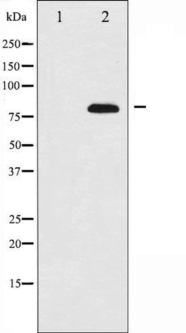 ETK Antibody in Western Blot (WB)