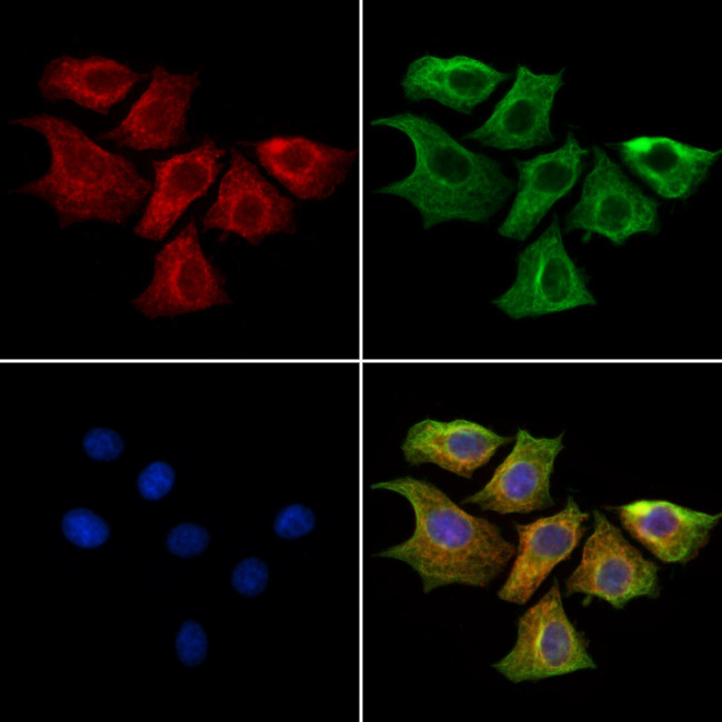 Ephrin B2 Antibody in Immunocytochemistry (ICC/IF)