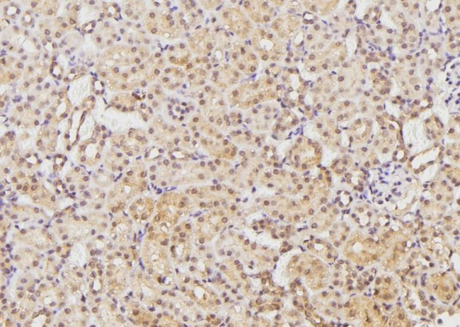 Ephrin B2 Antibody in Immunohistochemistry (Paraffin) (IHC (P))