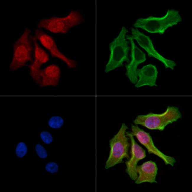 LIMK1/LIMK2 Antibody in Immunocytochemistry (ICC/IF)