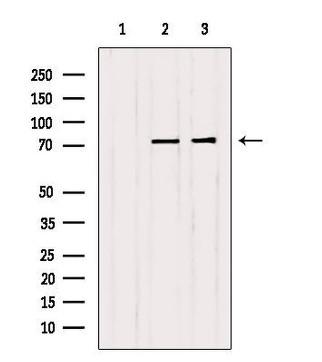 LIMK1/LIMK2 Antibody in Western Blot (WB)