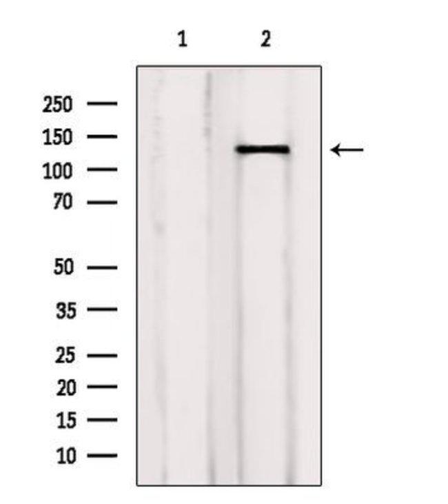 p130Cas Antibody in Western Blot (WB)