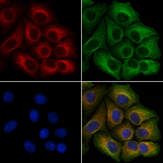 RHOA Antibody in Immunocytochemistry (ICC/IF)