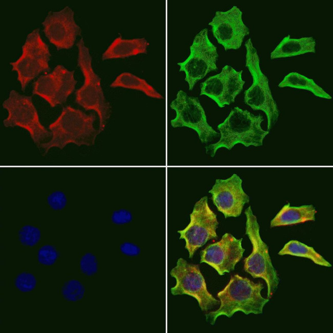 RHOA Antibody in Immunocytochemistry (ICC/IF)