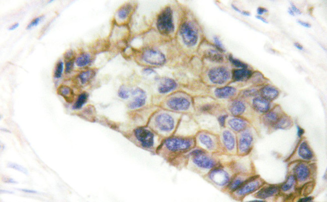 RHOA Antibody in Immunohistochemistry (Paraffin) (IHC (P))