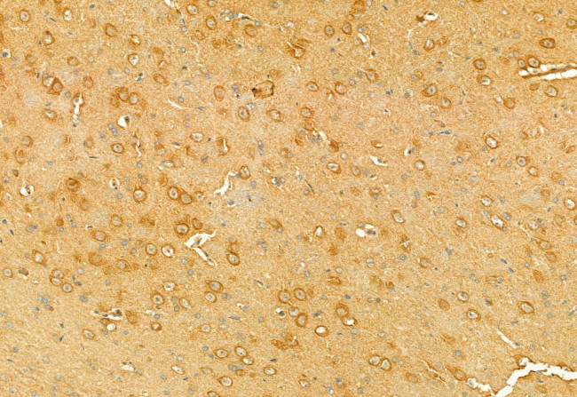 RHOA Antibody in Immunohistochemistry (Paraffin) (IHC (P))