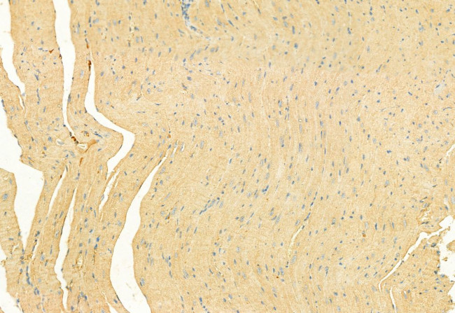 RHOA Antibody in Immunohistochemistry (Paraffin) (IHC (P))