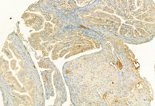 RHOA Antibody in Immunohistochemistry (Paraffin) (IHC (P))