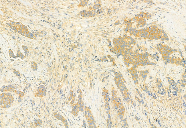 RHOA Antibody in Immunohistochemistry (Paraffin) (IHC (P))