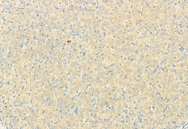 RHOA Antibody in Immunohistochemistry (Paraffin) (IHC (P))