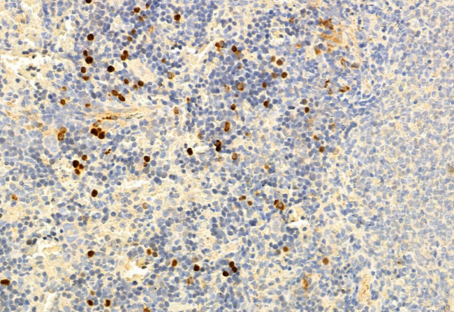 SMAD2/SMAD3 Antibody in Immunohistochemistry (Paraffin) (IHC (P))