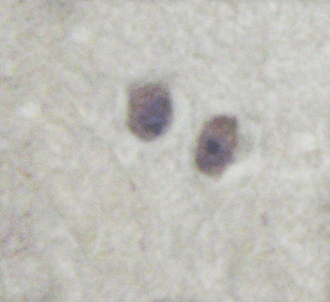 CDK5 Antibody in Immunohistochemistry (Paraffin) (IHC (P))