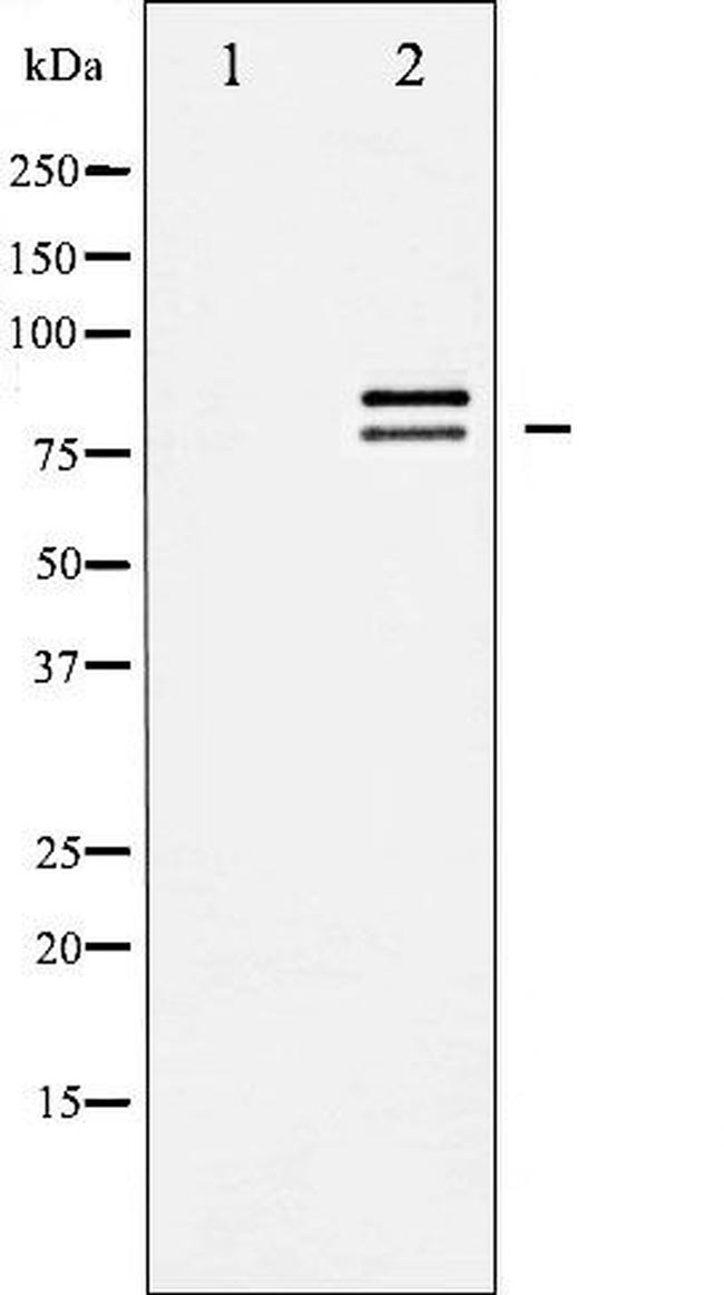 HSL Antibody in Western Blot (WB)