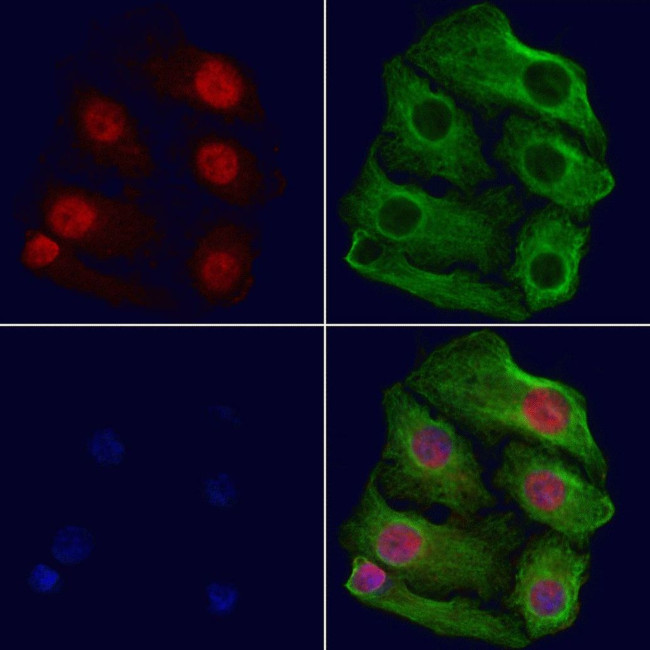 BIK Antibody in Immunocytochemistry (ICC/IF)