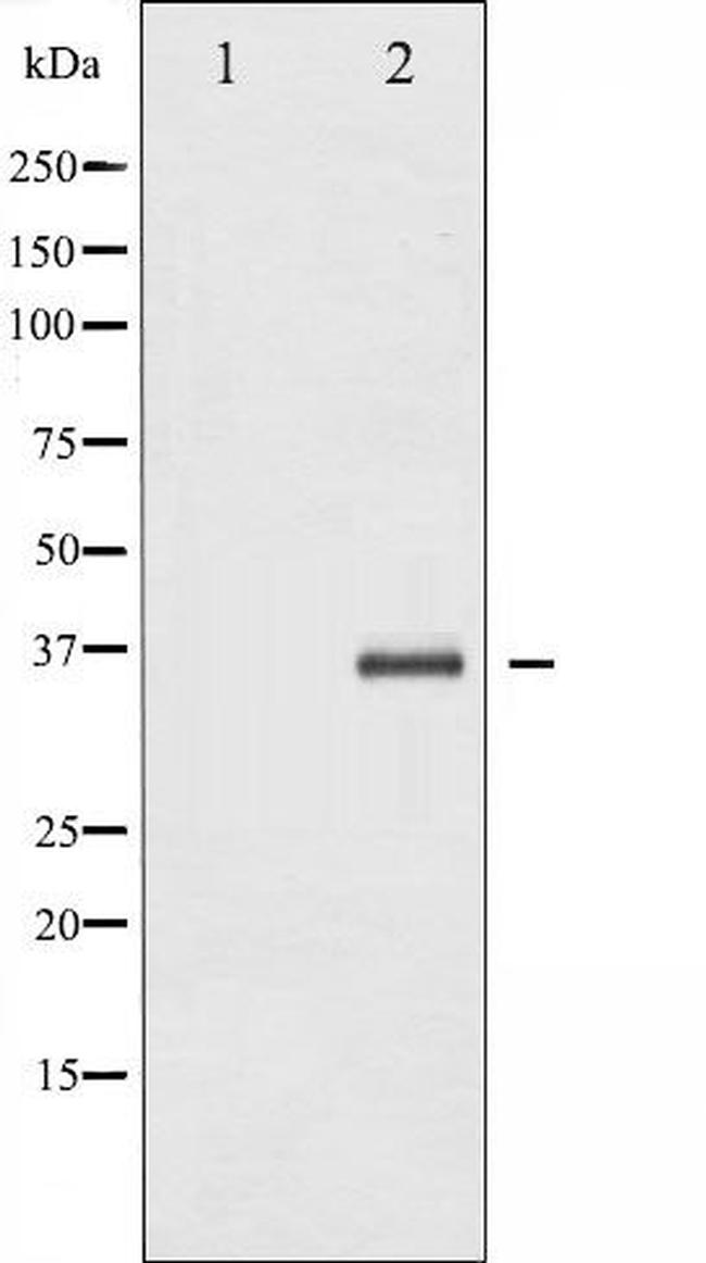 IkB beta Antibody in Western Blot (WB)