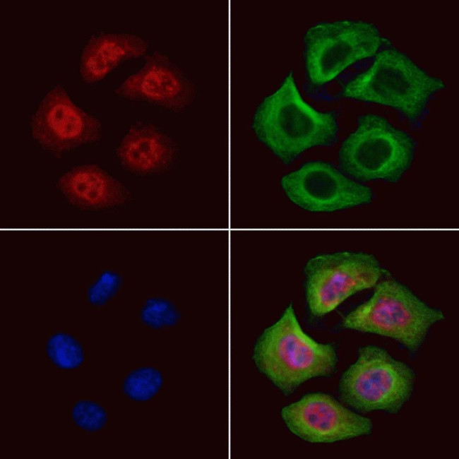 GRF-1 Antibody in Immunocytochemistry (ICC/IF)