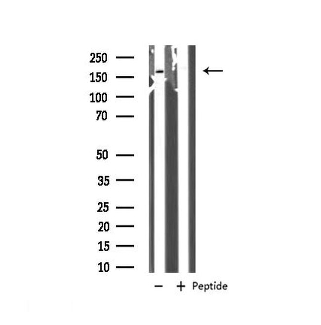 GRF-1 Antibody in Western Blot (WB)