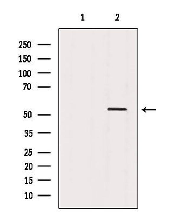 CaMKII alpha/beta/delta Antibody in Western Blot (WB)