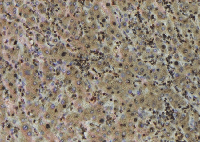 Phospho-TBC1D1 (Ser237) Antibody in Immunohistochemistry (Paraffin) (IHC (P))