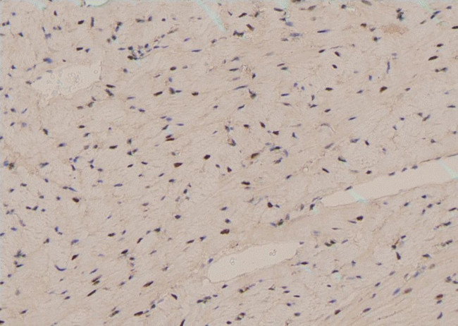 Phospho-TBC1D1 (Ser237) Antibody in Immunohistochemistry (Paraffin) (IHC (P))