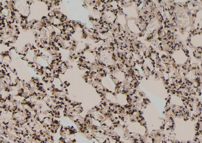 Phospho-TBC1D1 (Ser237) Antibody in Immunohistochemistry (Paraffin) (IHC (P))