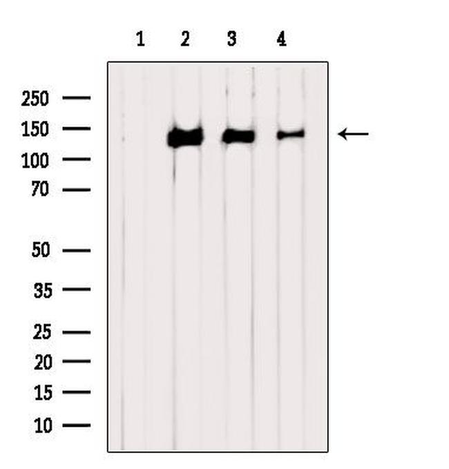 Phospho-TBC1D1 (Ser237) Antibody in Western Blot (WB)
