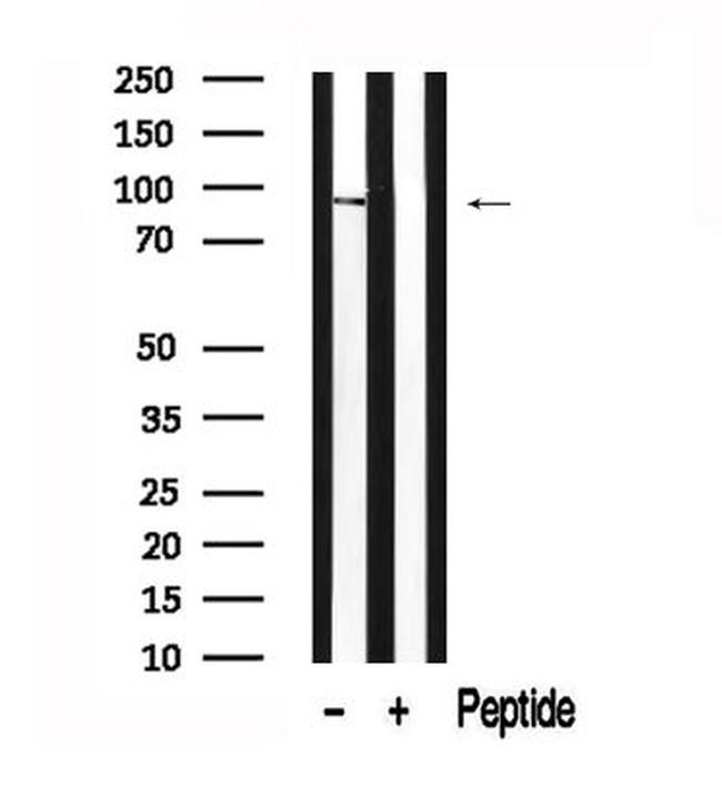 ADAM9 Antibody in Western Blot (WB)