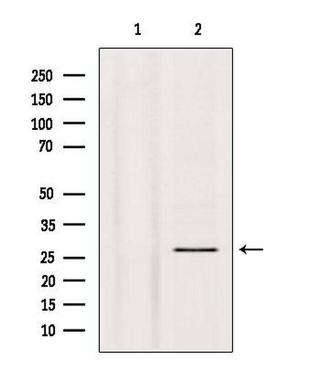 Phospho-p27 Kip1 (Thr157) Antibody in Western Blot (WB)