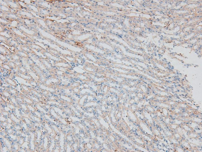 Phospho-p27 Kip1 (Ser178) Antibody in Immunohistochemistry (Paraffin) (IHC (P))