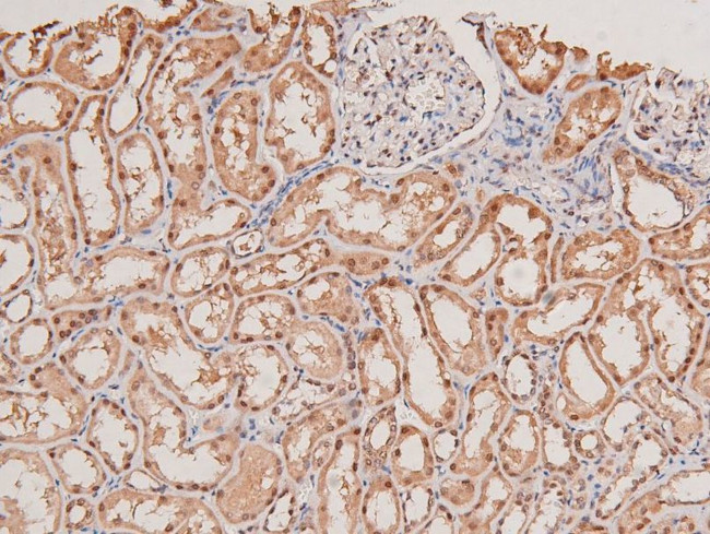 Phospho-STK38/STK38L (Thr444, Thr442) Antibody in Immunohistochemistry (Paraffin) (IHC (P))