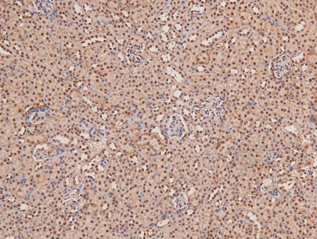 Phospho-STK38/STK38L (Thr444, Thr442) Antibody in Immunohistochemistry (Paraffin) (IHC (P))