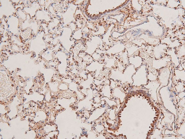 Phospho-STK38/STK38L (Thr444, Thr442) Antibody in Immunohistochemistry (Paraffin) (IHC (P))