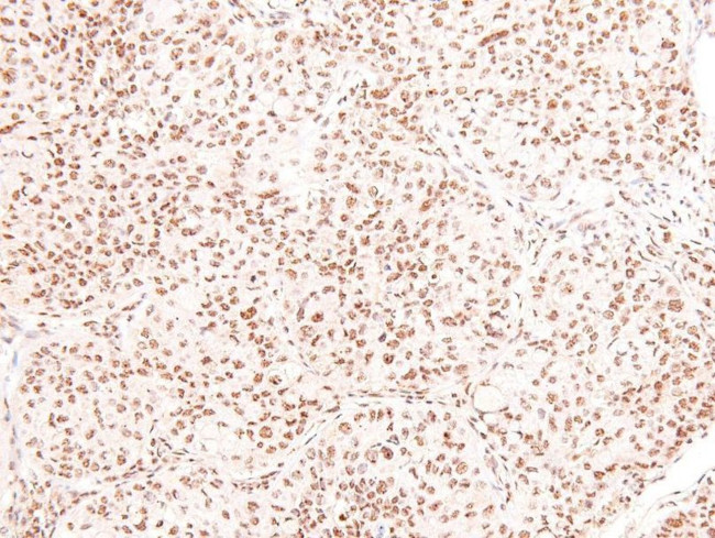 Phospho-PKC theta (Tyr90) Antibody in Immunohistochemistry (Paraffin) (IHC (P))