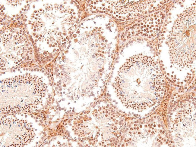 Phospho-PKC theta (Tyr90) Antibody in Immunohistochemistry (Paraffin) (IHC (P))