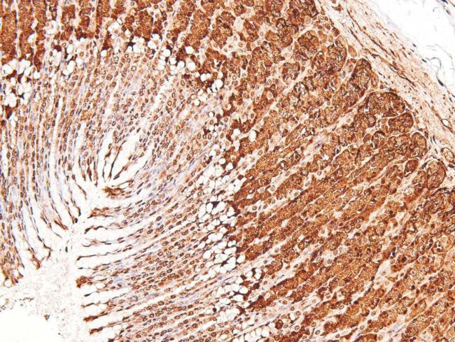 Phospho-PKC theta (Tyr90) Antibody in Immunohistochemistry (Paraffin) (IHC (P))