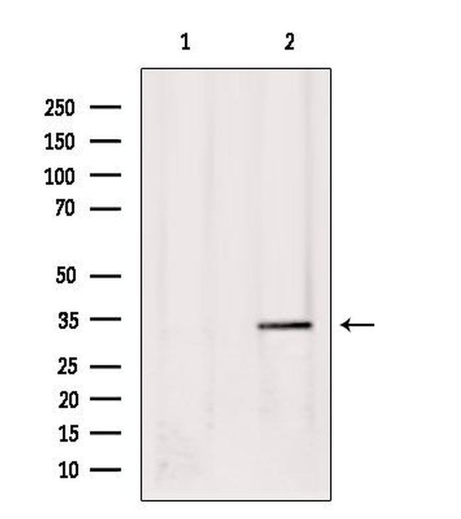 Phospho-USF1 (Thr153) Antibody in Western Blot (WB)