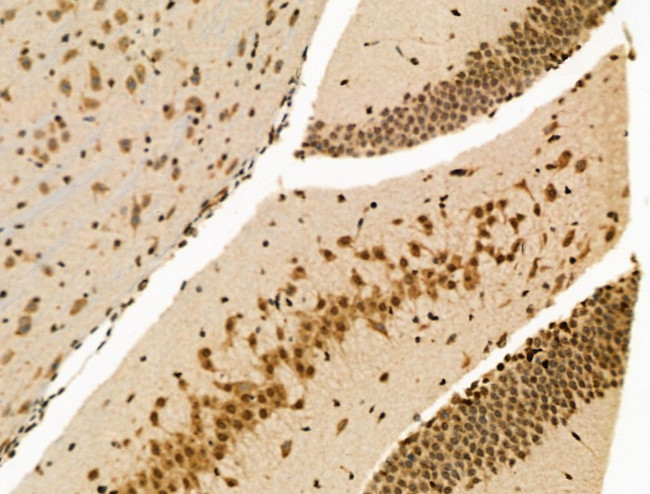 Phospho-USF1 (Thr153) Antibody in Immunohistochemistry (Paraffin) (IHC (P))