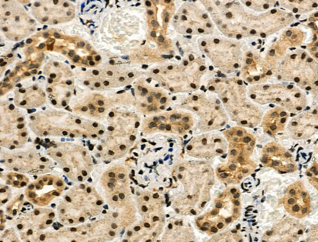 Phospho-USF1 (Thr153) Antibody in Immunohistochemistry (Paraffin) (IHC (P))