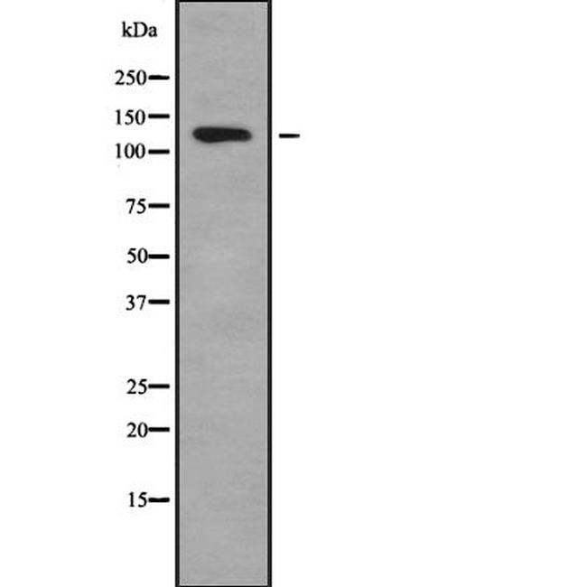 ADCY1 Antibody in Western Blot (WB)