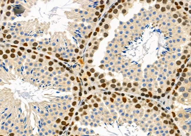 Ubiquilin 4 Antibody in Immunohistochemistry (Paraffin) (IHC (P))