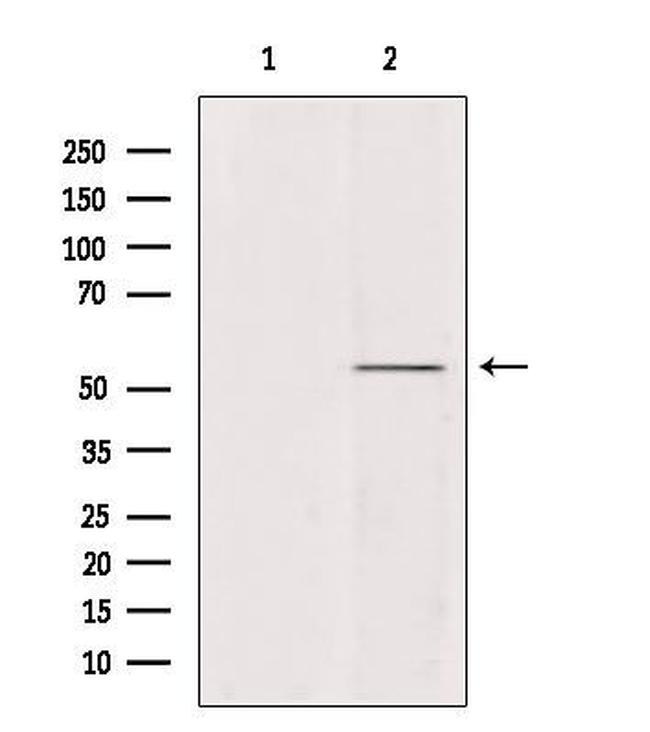 Ubiquilin 4 Antibody in Western Blot (WB)