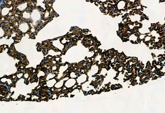 APOBEC3A Antibody in Immunohistochemistry (Paraffin) (IHC (P))