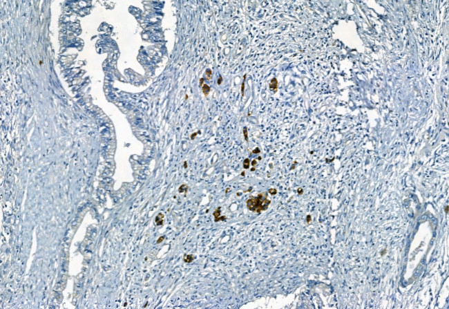 APOBEC3A Antibody in Immunohistochemistry (Paraffin) (IHC (P))