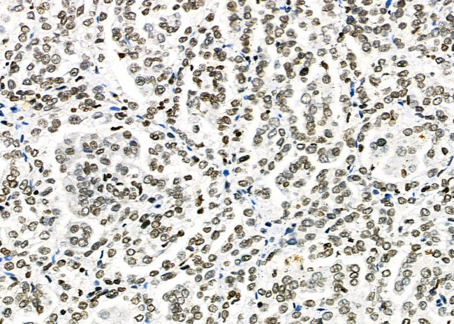 C/EBP delta/epsilon Antibody in Immunohistochemistry (Paraffin) (IHC (P))