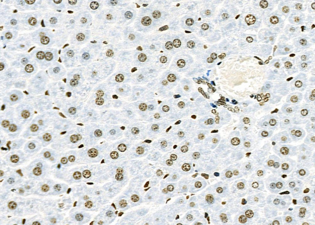 C/EBP delta/epsilon Antibody in Immunohistochemistry (Paraffin) (IHC (P))